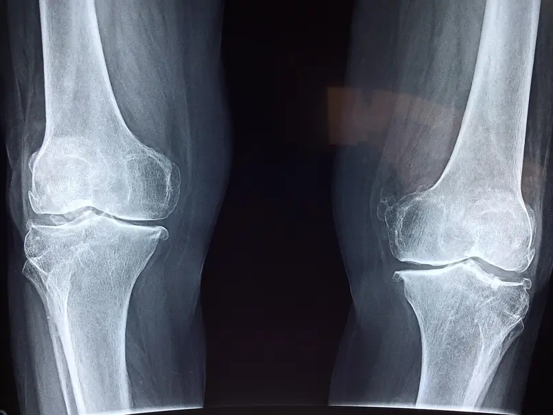Peptides for Joint Pain